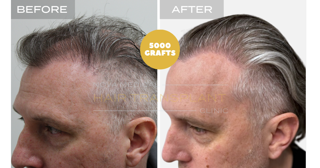 Before and after case 19
