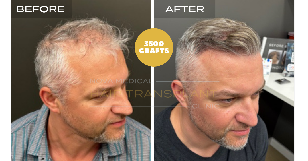 Before and after case 7